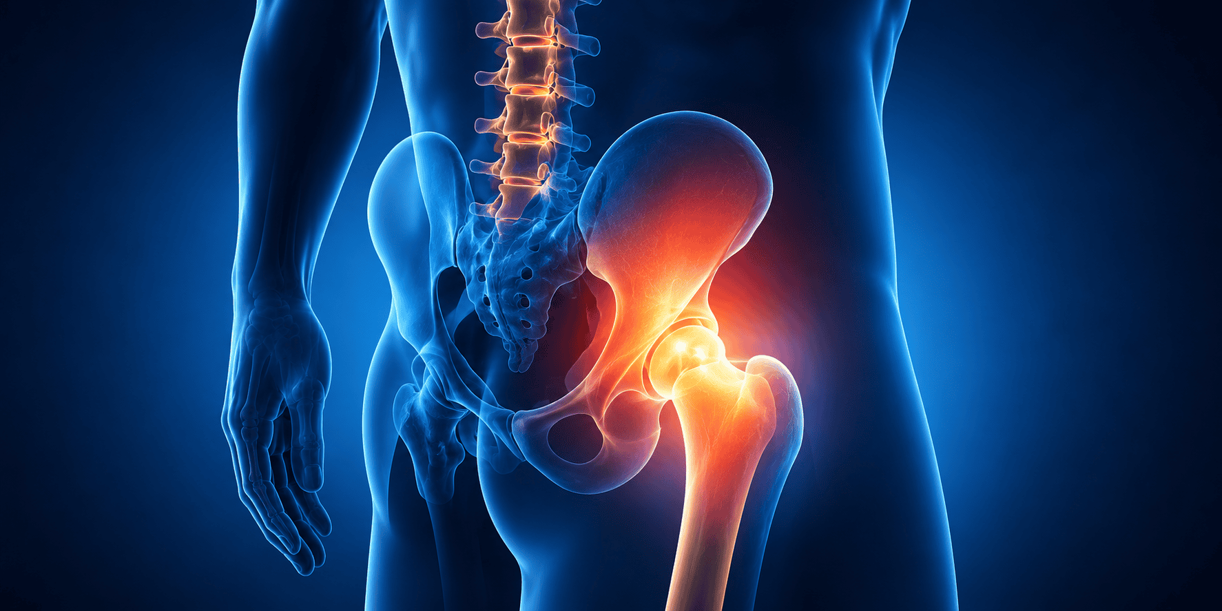 Stem-Cells-For-Hip-Pain-arthritis