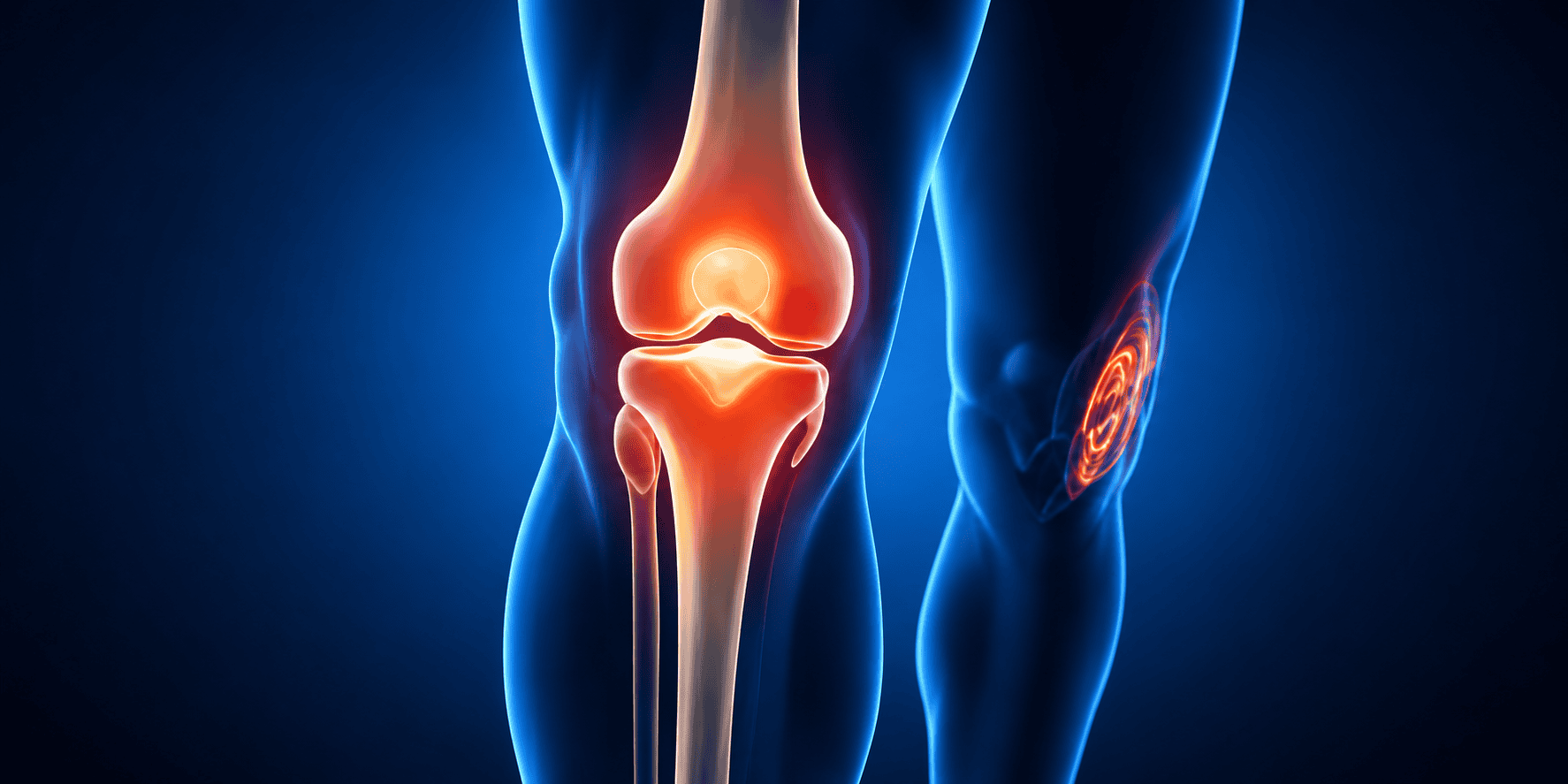 Stem-Cells-For-Knees
